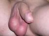 Pralle Eier