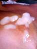 devotep f