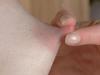 Nippel